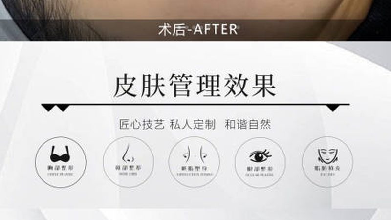 家用激光祛斑仪器代理：揭秘行业背后的真相**