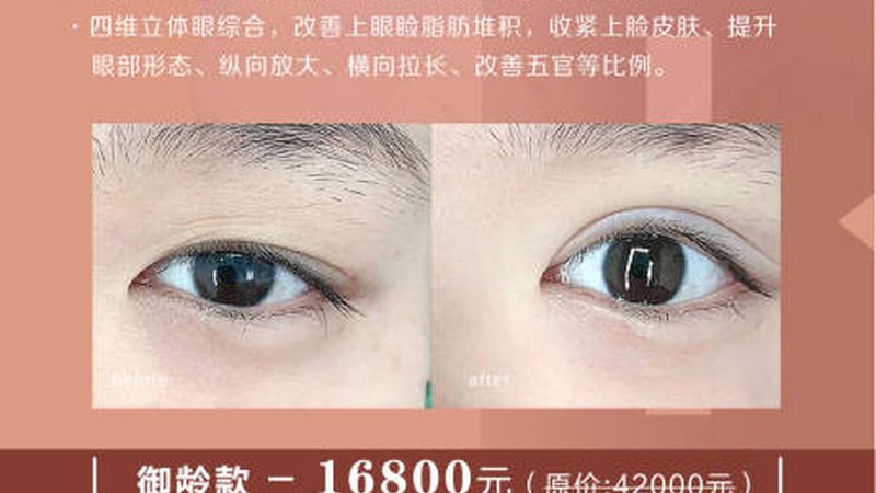 抗衰瑜伽器材批发厂家