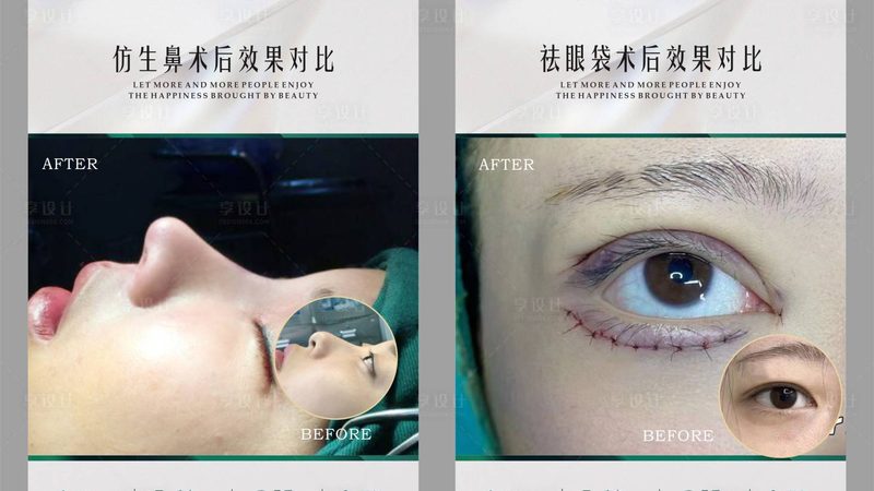 医美咨询师兼职收入如何