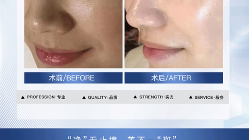 进口水光针，如何挑选品质与安全并存的选择？**