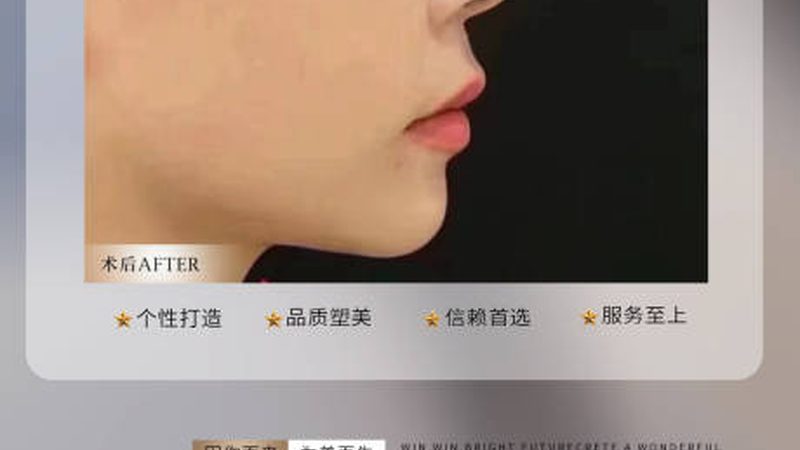 揭秘医美项目价格表：隐藏收费的真相