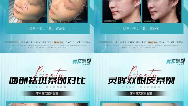 激光脱毛OEM厂家排名：揭秘行业实力与选型关键