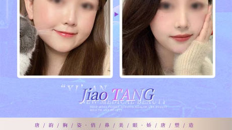 整形美容术后恢复期：揭秘恢复过程中的关键点**