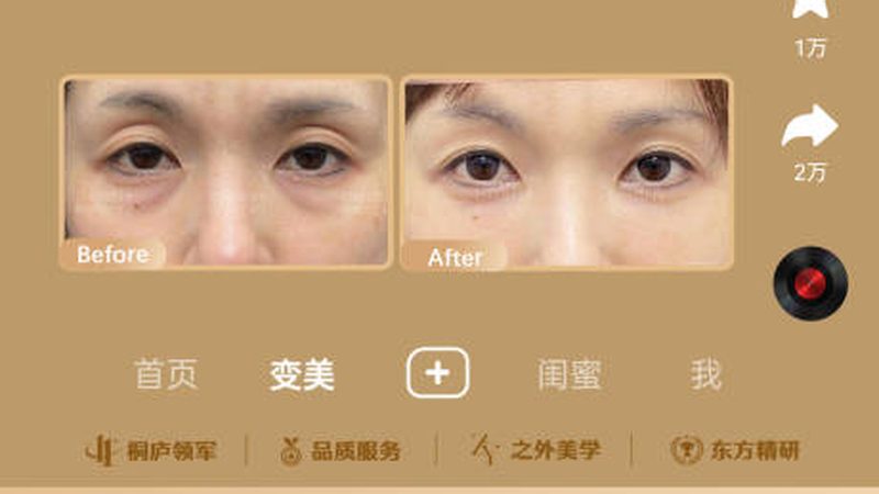 抗衰干细胞治疗，揭秘其价格背后的真相