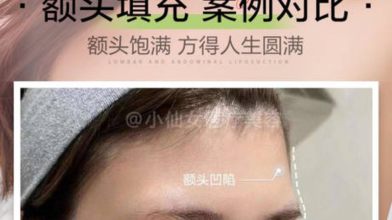 热玛吉全脸加脖子，揭秘价格背后的真相