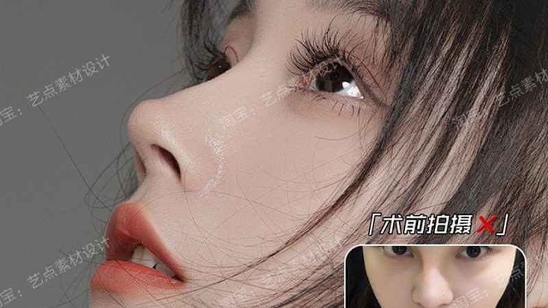 肉毒素注射效果显现，揭秘最佳时间点