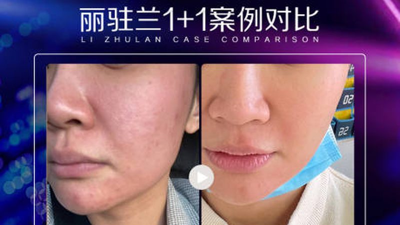 整形医院与美容院项目划分，揭秘医美服务差异