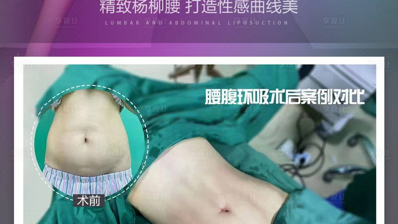 光子嫩肤后敷面膜用什么牌子好